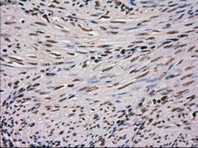 Immunohistochemistry-Paraffin: SCY1 like 3 Antibody (OTI1A5) [NBP1-47956]