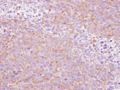Immunohistochemistry-Paraffin: SCY1 like 3 Antibody [NBP1-33190]