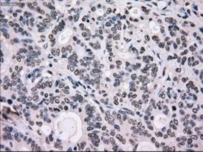 Immunohistochemistry: SCY1 like 3 Antibody (OTI1A5) - Azide and BSA Free [NBP2-74025]