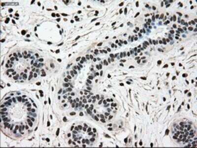 Immunohistochemistry: SCY1 like 3 Antibody (OTI1A5) - Azide and BSA Free [NBP2-74025]