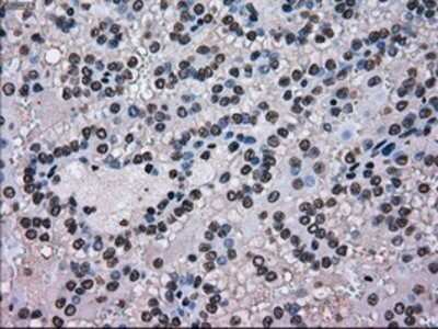 Immunohistochemistry: SCY1 like 3 Antibody (OTI1A5) - Azide and BSA Free [NBP2-74025]