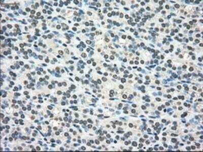 Immunohistochemistry: SCY1 like 3 Antibody (OTI1A5) - Azide and BSA Free [NBP2-74025]