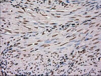 Immunohistochemistry: SCY1 like 3 Antibody (OTI1A5) - Azide and BSA Free [NBP2-74025]
