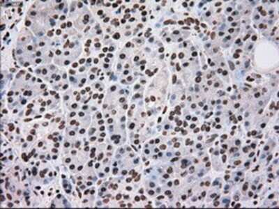 Immunohistochemistry: SCY1 like 3 Antibody (OTI1A5) - Azide and BSA Free [NBP2-74025]
