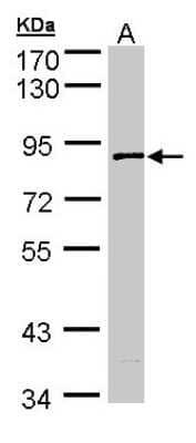 Western Blot: SCY1 like 3 Antibody [NBP1-33190]