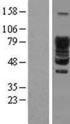 Western Blot: SCY1 like 3 Overexpression Lysate [NBL1-15757]