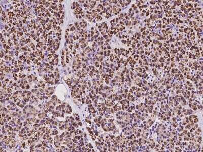 Immunohistochemistry-Paraffin: SCYL1 Antibody [NBP2-97454]