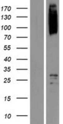 Western Blot: SCYL1 Overexpression Lysate [NBP2-08345]