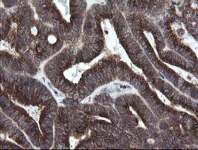 Immunohistochemistry: SCYL1BP1 Antibody (OTI4F11) [NBP2-45912]