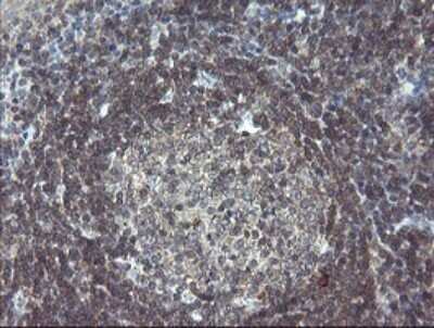 Immunohistochemistry: SCYL1BP1 Antibody (OTI4F11) [NBP2-45912]