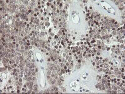 Immunohistochemistry: SCYL1BP1 Antibody (OTI4F11) [NBP2-45912]