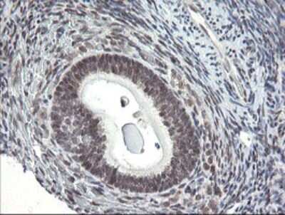 Immunohistochemistry: SCYL1BP1 Antibody (OTI4F11) [NBP2-45912]
