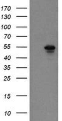 Western Blot: SCYL1BP1 Antibody (OTI2H6)Azide and BSA Free [NBP2-74030]