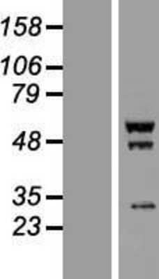 Western Blot: SCYL1BP1 Overexpression Lysate [NBP2-05418]