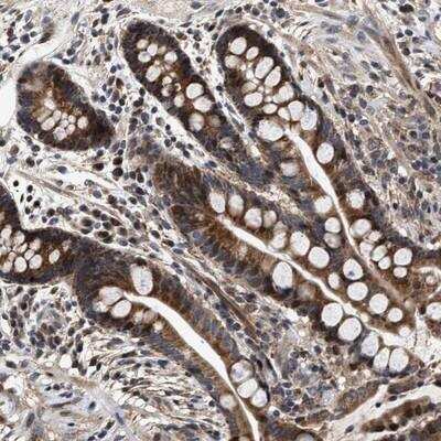 Immunohistochemistry-Paraffin: SCYL2 Antibody [NBP1-81416]