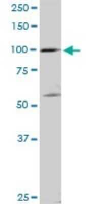 Western Blot: SCYL2 Antibody [H00055681-D01P]