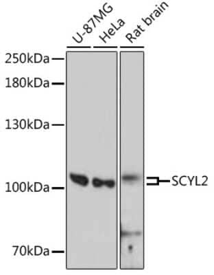 Western Blot: SCYL2 AntibodyAzide and BSA Free [NBP2-93250]