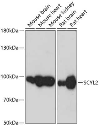 Western Blot: SCYL2 AntibodyAzide and BSA Free [NBP2-93622]