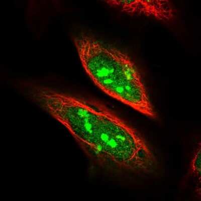 Immunocytochemistry/ Immunofluorescence: SDAD1 Antibody [NBP1-90434]