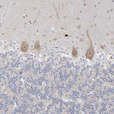 Immunohistochemistry-Paraffin: SDAD1 Antibody [NBP1-90434]
