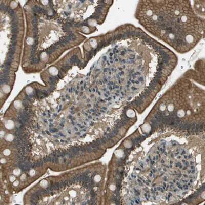 Immunohistochemistry-Paraffin: SDC3 Antibody [NBP1-82522]