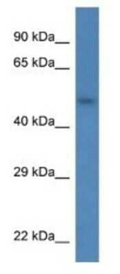 Western Blot: SDC3 Antibody [NBP1-74216]