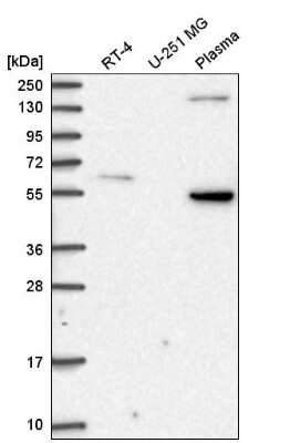 Western Blot: SDC3 Antibody [NBP2-56049]