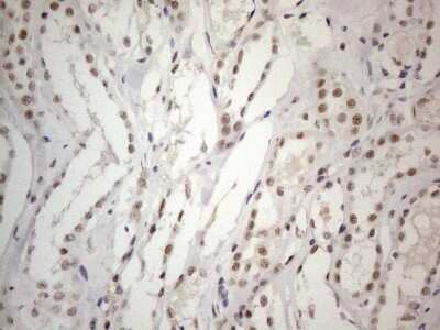Immunohistochemistry: SDCCAG10 Antibody (OTI4C8) [NBP2-46409]