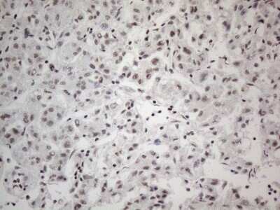 Immunohistochemistry: SDCCAG10 Antibody (OTI4C8) [NBP2-46409]