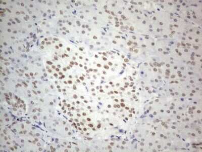 Immunohistochemistry: SDCCAG10 Antibody (OTI4C8) [NBP2-46409]