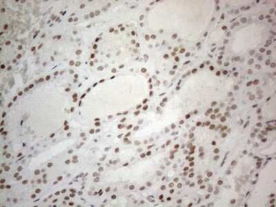 Immunohistochemistry: SDCCAG10 Antibody (OTI4C8) [NBP2-46409]