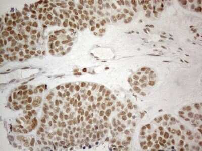 Immunohistochemistry: SDCCAG10 Antibody (OTI4C8) [NBP2-46409]