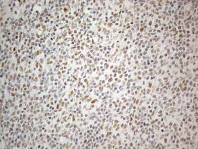 Immunohistochemistry: SDCCAG10 Antibody (OTI4C8) [NBP2-46409]