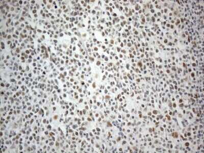 Immunohistochemistry: SDCCAG10 Antibody (OTI4C8) [NBP2-46409]