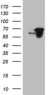 Western Blot: SDCCAG10 Antibody (OTI4C8) [NBP2-46409]