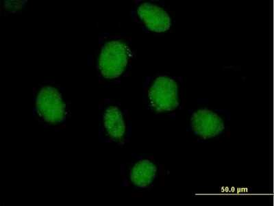 Immunocytochemistry/ Immunofluorescence: SDCCAG10 Antibody [H00010283-B01P]