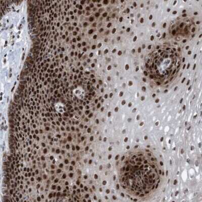 Immunohistochemistry-Paraffin: SDCCAG10 Antibody [NBP1-82508]