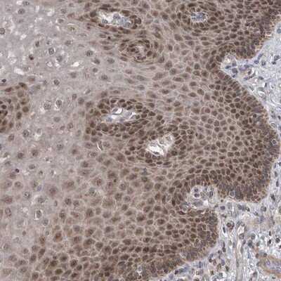 Immunohistochemistry-Paraffin: SDCCAG10 Antibody [NBP1-82509]
