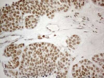 Immunohistochemistry: SDCCAG10 Antibody (OTI4C8) - Azide and BSA Free [NBP2-74031]