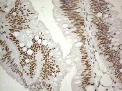 Immunohistochemistry: SDCCAG10 Antibody (OTI4C8) - Azide and BSA Free [NBP2-74031]