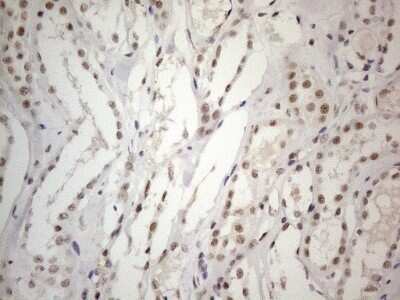 Immunohistochemistry: SDCCAG10 Antibody (OTI4C8) - Azide and BSA Free [NBP2-74031]