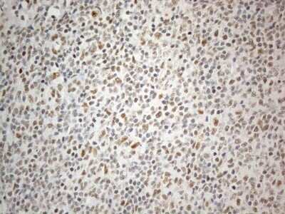 Immunohistochemistry: SDCCAG10 Antibody (OTI4C8) - Azide and BSA Free [NBP2-74031]