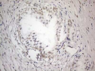 Immunohistochemistry: SDCCAG10 Antibody (OTI4C8) - Azide and BSA Free [NBP2-74031]