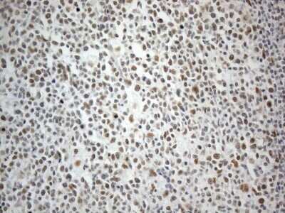 Immunohistochemistry: SDCCAG10 Antibody (OTI4C8) - Azide and BSA Free [NBP2-74031]