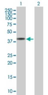 Western Blot: SDCCAG10 Antibody [H00010283-B01P]