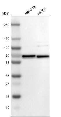 Western Blot: SDCCAG10 Antibody [NBP1-82508]