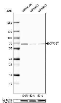 Western Blot: SDCCAG10 Antibody [NBP1-82508]