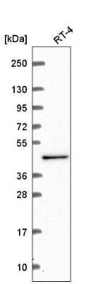 Western Blot: SDCCAG10 Antibody [NBP2-56438]