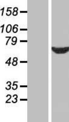 Western Blot: SDCCAG10 Overexpression Lysate [NBP2-10439]