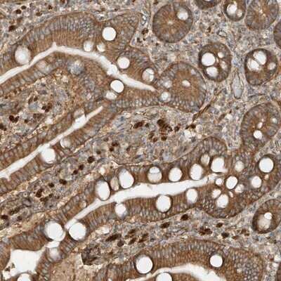 Immunohistochemistry-Paraffin: SDCCAG3 Antibody [NBP1-82507]